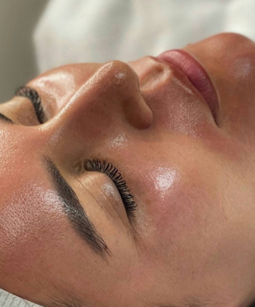 Huidbehandeling bij SKINSIS Clinic