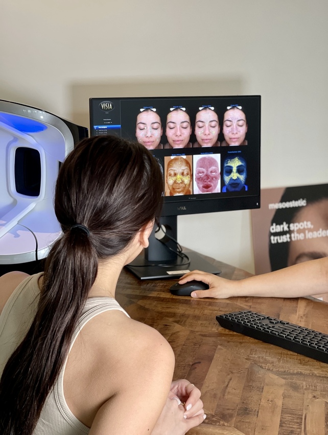 Visia-huidscan analyse tijdens consult bij SKINSIS Clinic