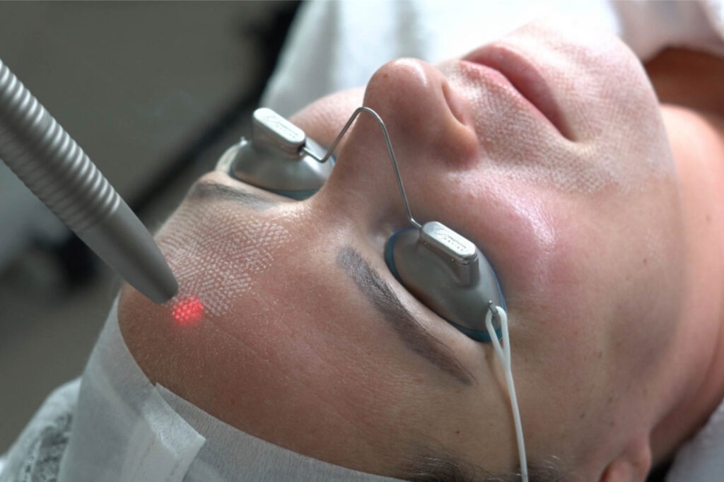 Huidbehandeling bij SKINSIS Clinic
