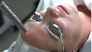 Huidbehandeling bij SKINSIS Clinic
