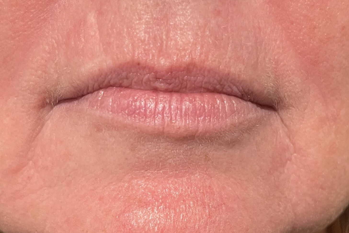 Huidbehandeling bij SKINSIS Clinic