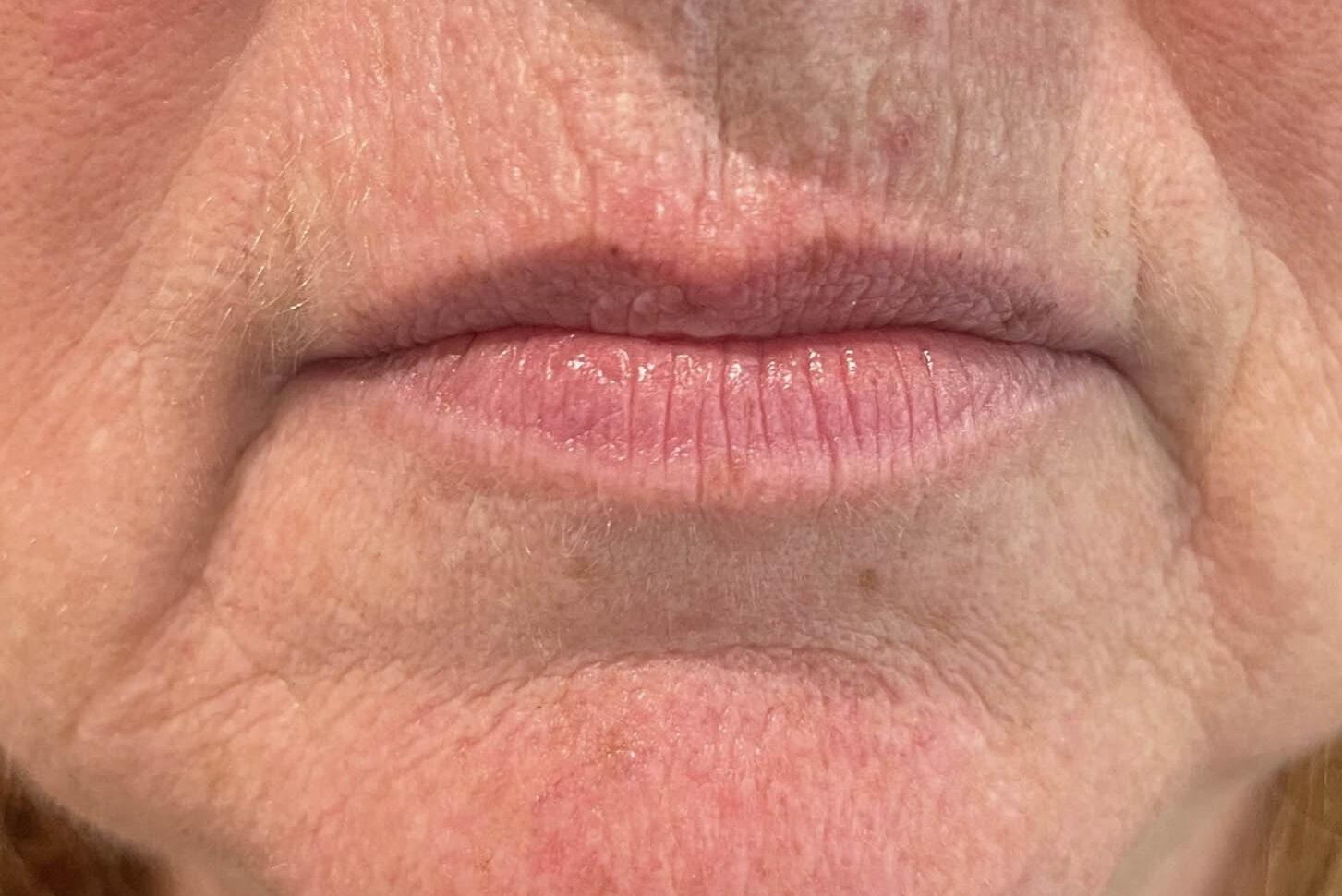 Huidbehandeling bij SKINSIS Clinic