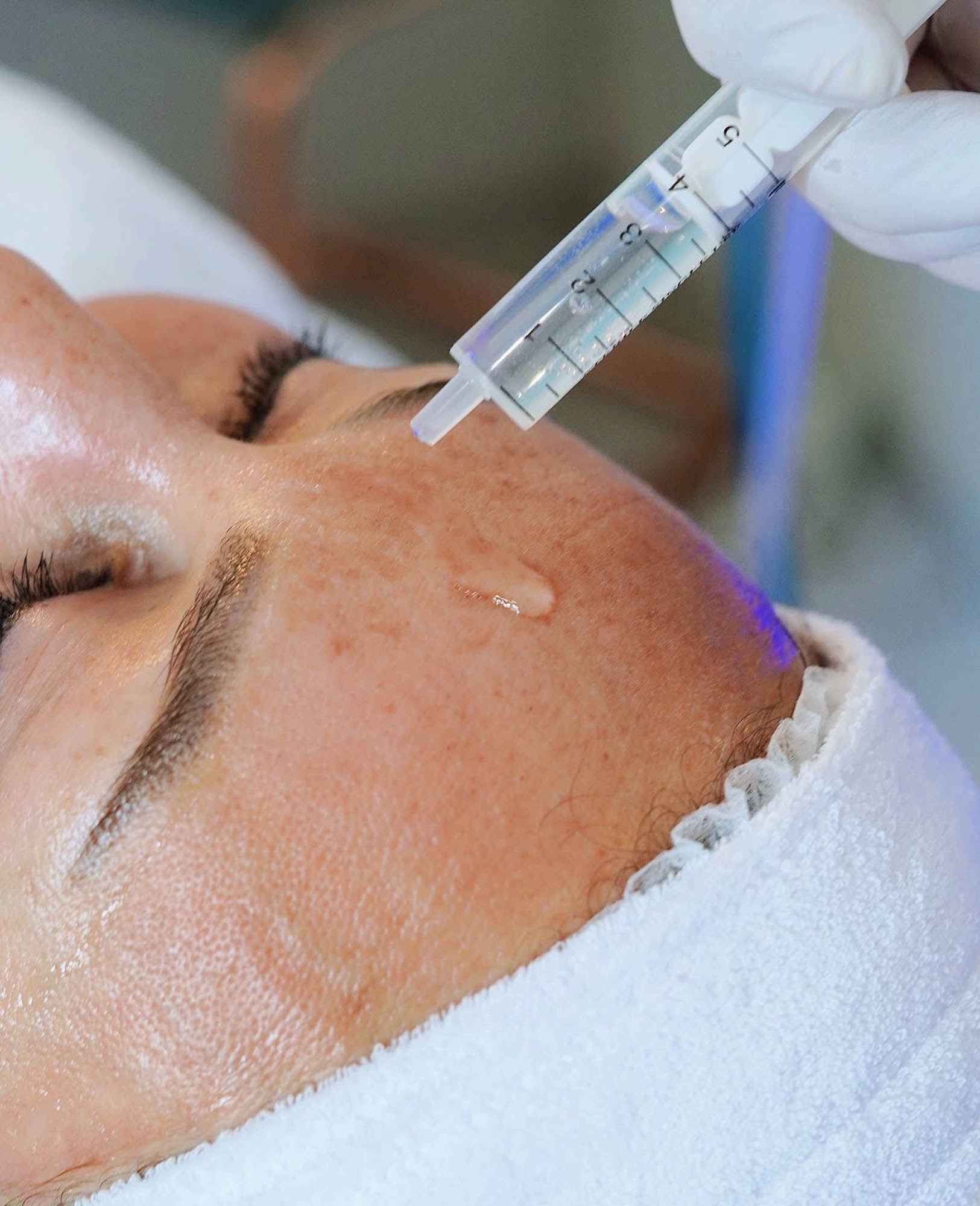 Huidbehandeling bij SKINSIS Clinic