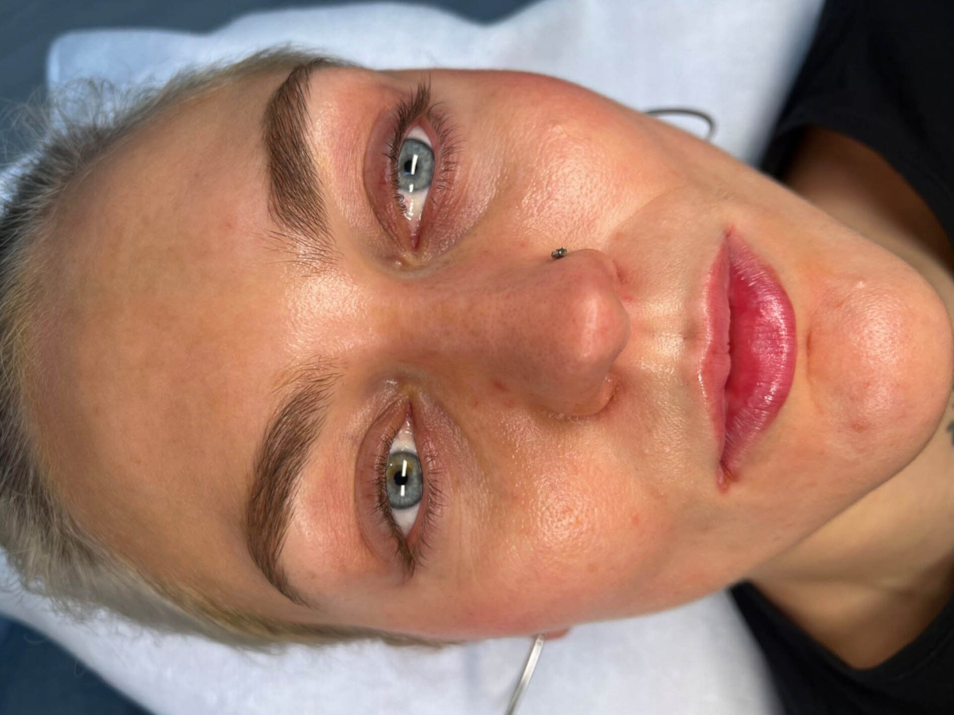 Huidbehandeling bij SKINSIS Clinic