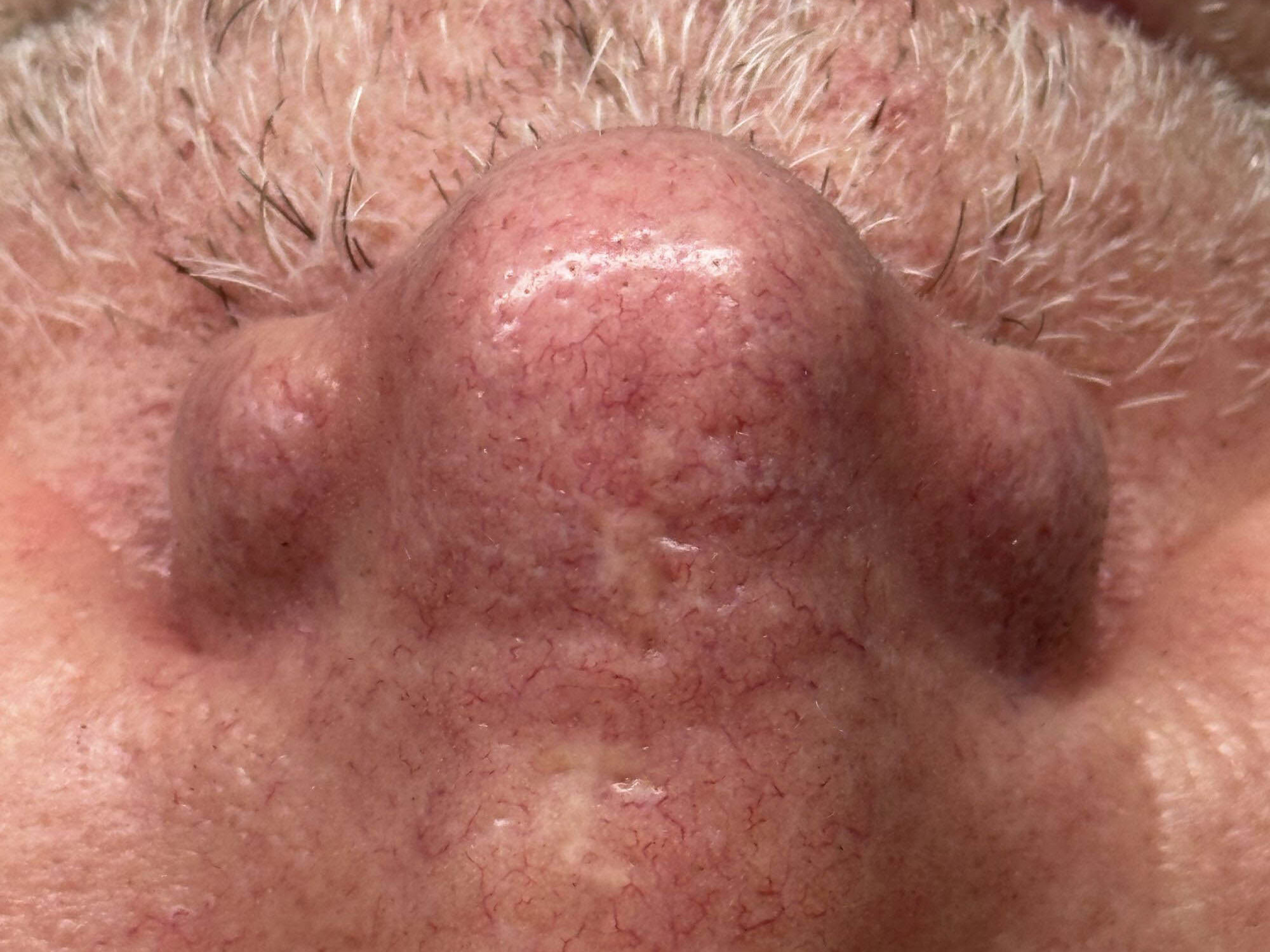Huidbehandeling bij SKINSIS Clinic