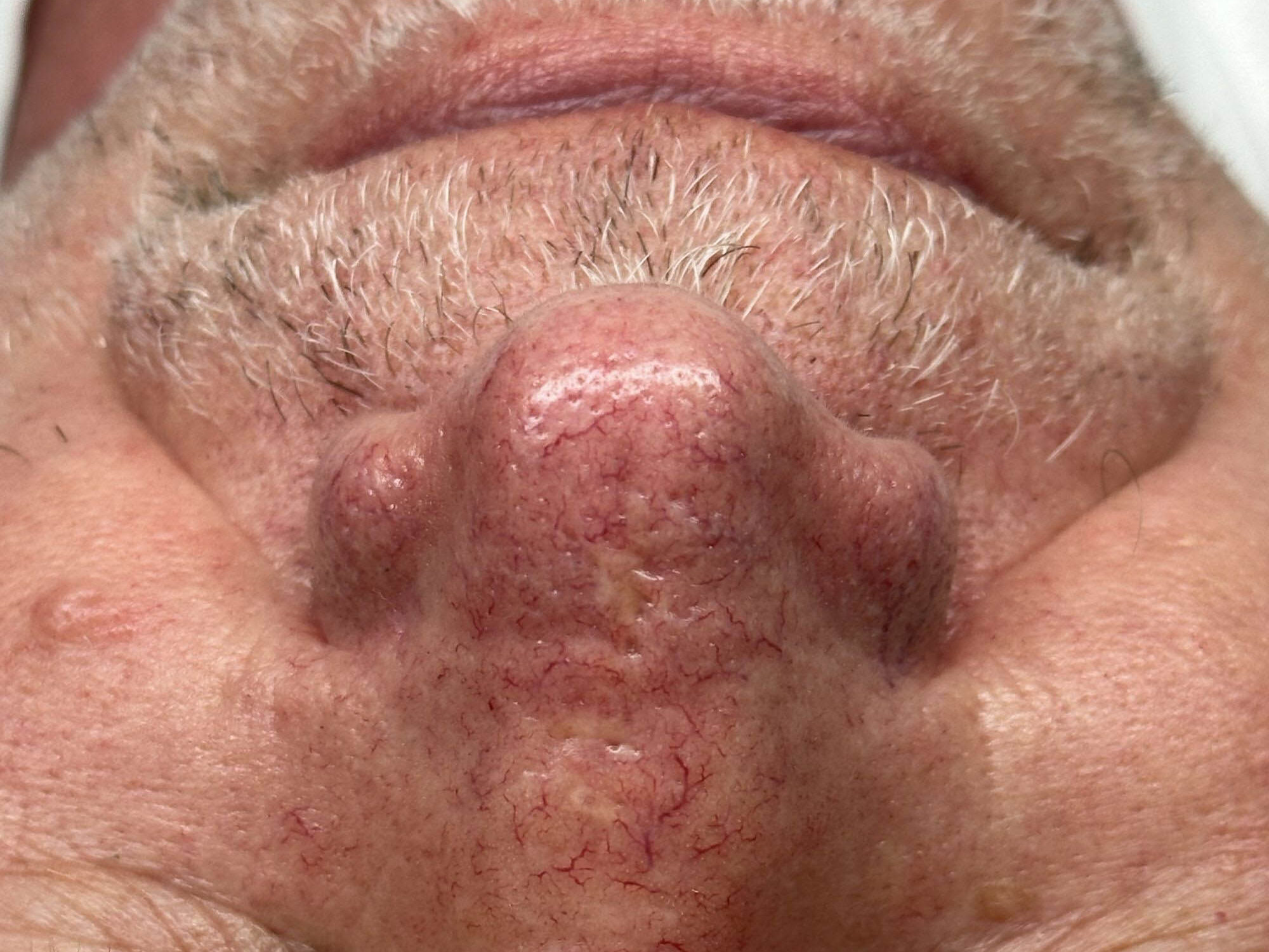Huidbehandeling bij SKINSIS Clinic