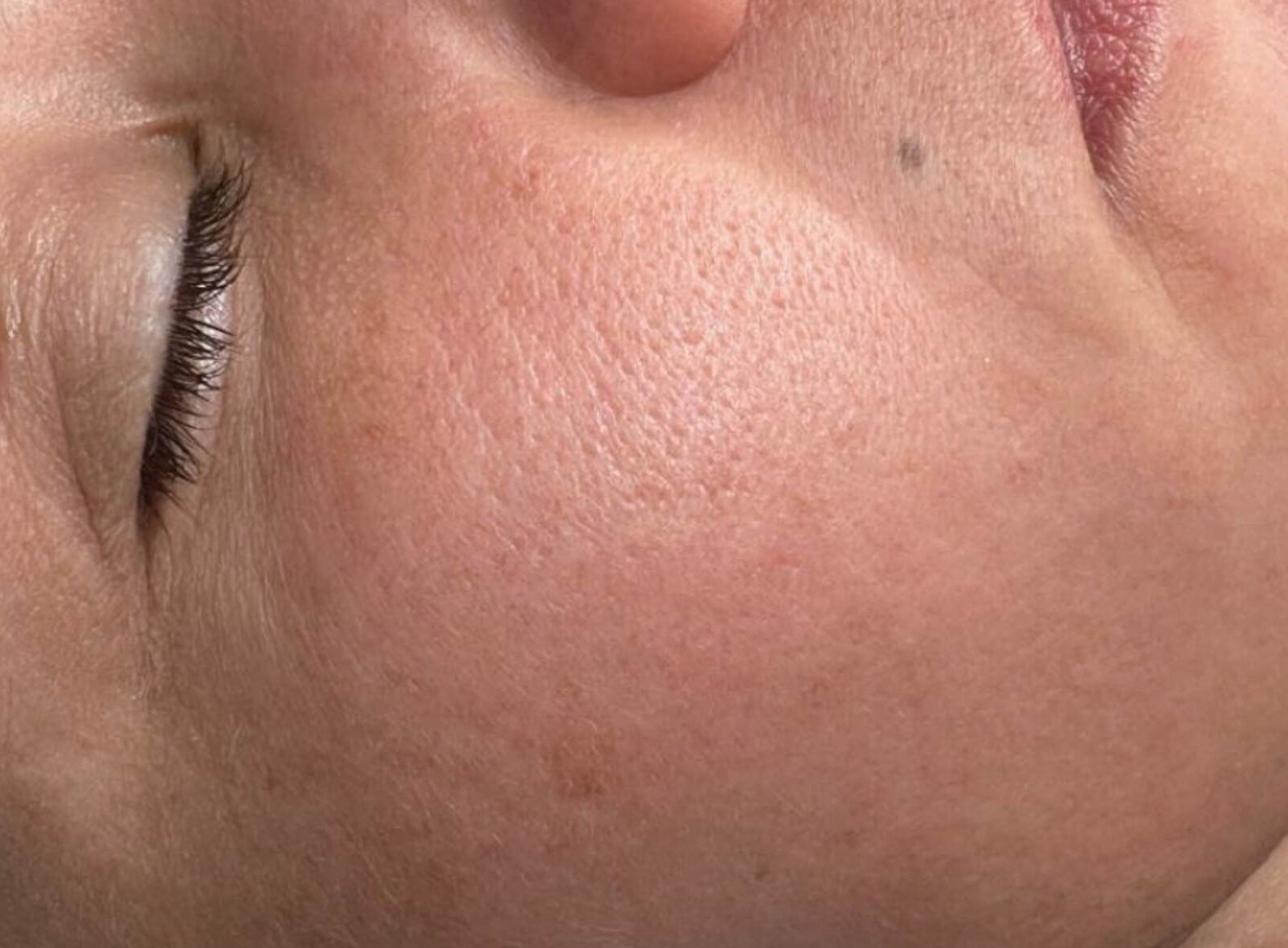 Huidbehandeling bij SKINSIS Clinic
