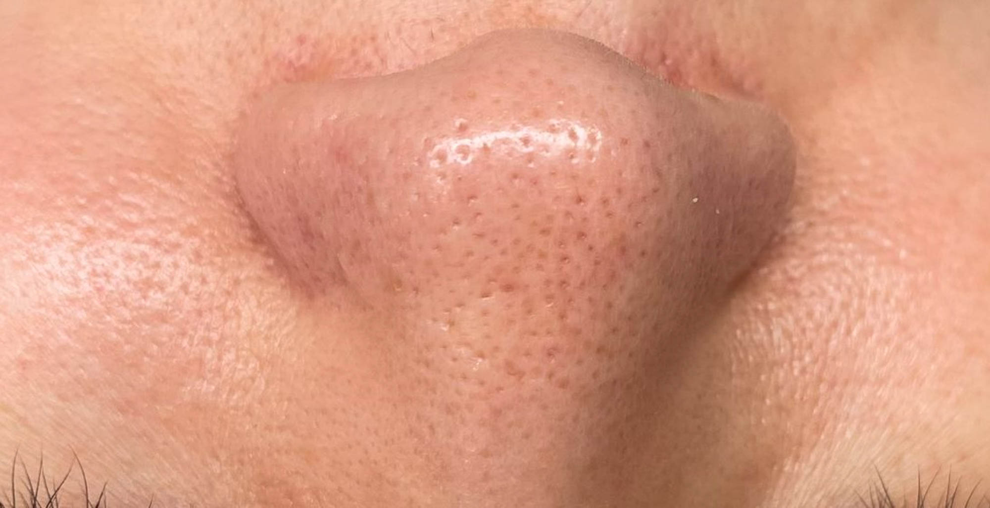 Huidbehandeling bij SKINSIS Clinic