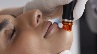 Ava_Treatment_Face_2496