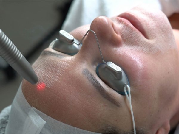 Huidbehandeling bij SKINSIS Clinic