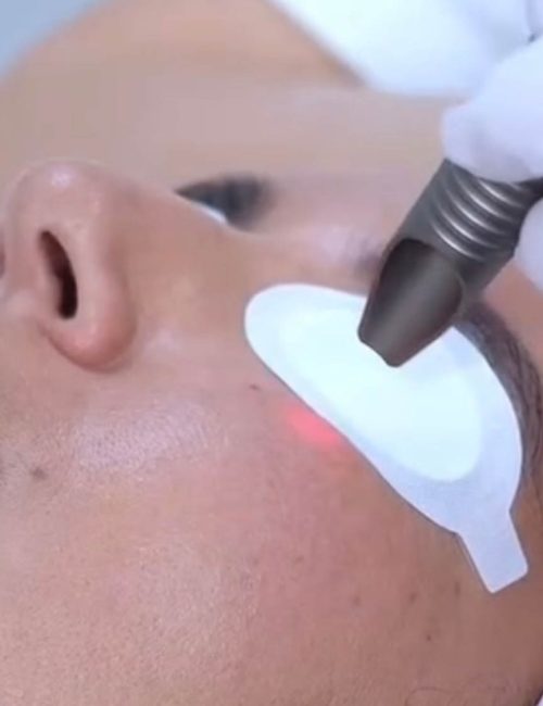 Huidbehandeling bij SKINSIS Clinic