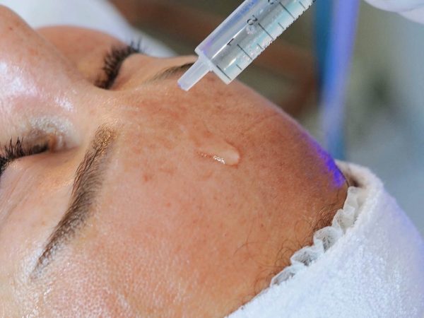 Huidbehandeling bij SKINSIS Clinic