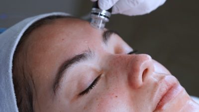 hydrafacial-3